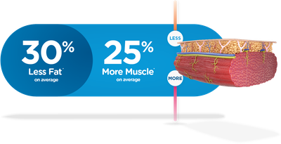 30% Less Fat on average | 25% More Muscle on average - Emsculpt NEO